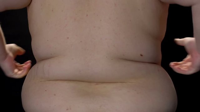 Obese man upset of waist fat folds, weight loss difficulties, overeating effect