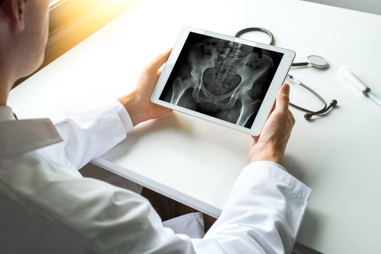 Doctor watching x-ray of hips bones on a digital tablet
