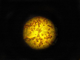 Asian rust (Phakopsora pachyrhizi) on soy leaf view through the lens of a microscope