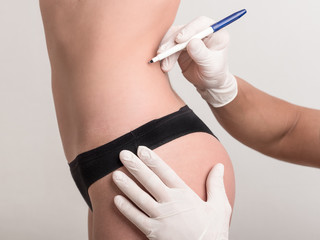 Beautician touch and draw correction lines on woman body. Before plastic surgery operation.