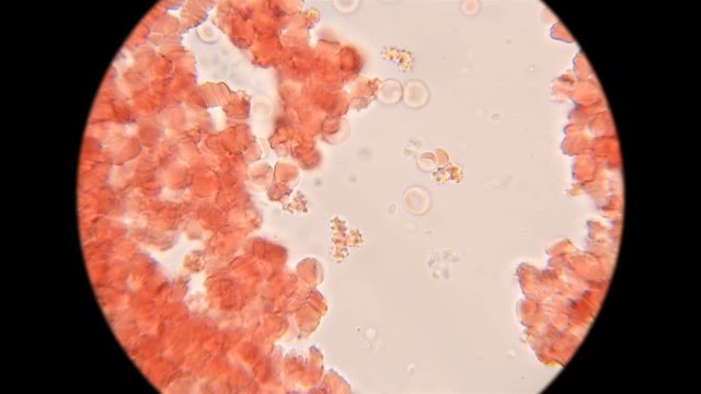 blood of a dog under a microscope