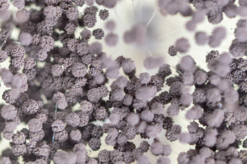 Rhizopus (bread mold) is a genus of common saprophytic fungi,Rhizopus (bread mold) under the microscope.