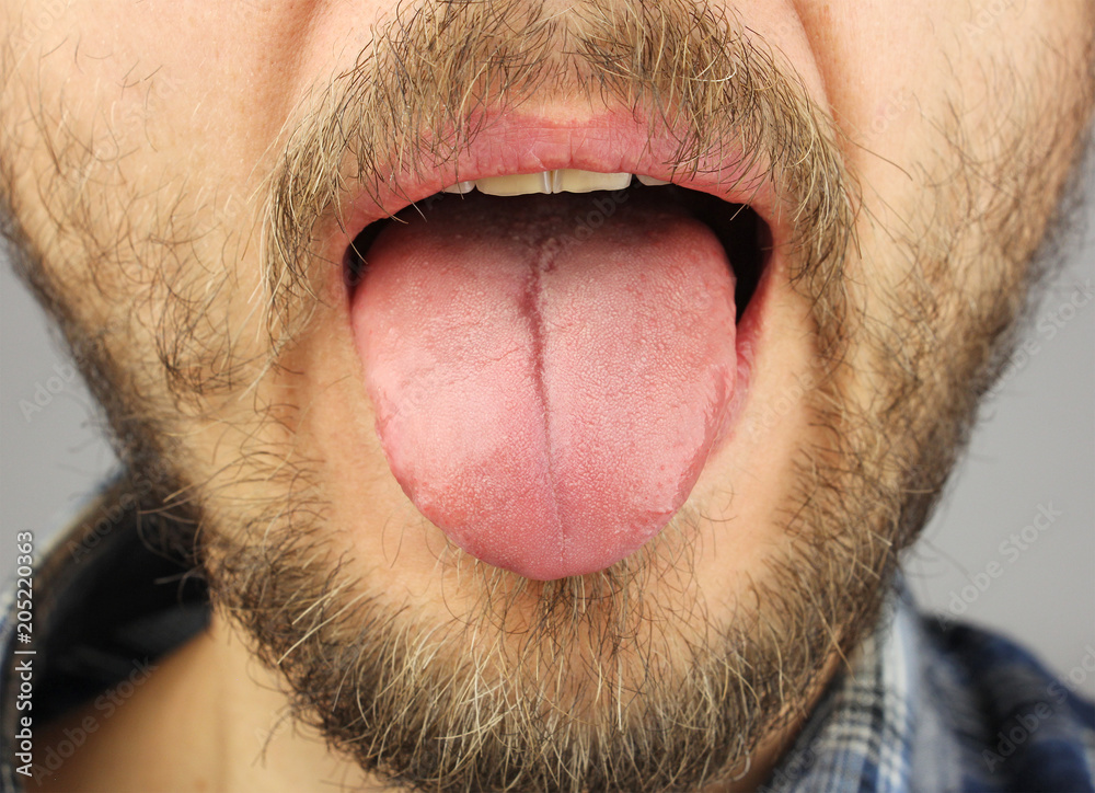 Wall mural man with a beard opened his mouth and stuck out his tongue