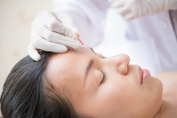 Woman receiving facial acupuncture treatment - obrazy, fototapety, plakaty
