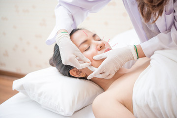 Obraz na płótnie Canvas Woman receiving facial acupuncture treatment