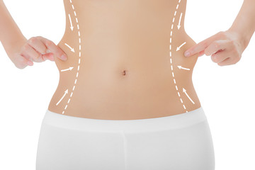 Woman grabbing skin on her flanks with the drawing arrows, Lose weight and liposuction cellulite...