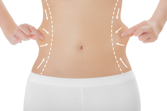 Woman Grabbing Skin On Her Flanks With The Drawing Arrows, Lose Weight And Liposuction Cellulite Removal Concept, Isolated On White Background.