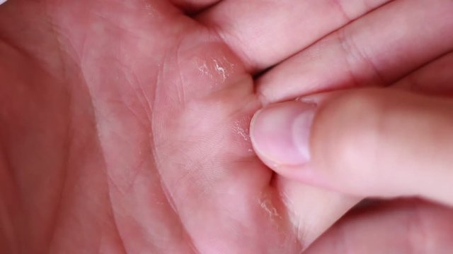 Male callous hand close up