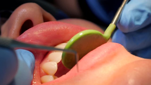 Portrait of woman patient at dentist cabinet for check up and dental cleaning. Dentist checks the teeth of young girl with mirror and flashlight. Cosmetic dentistry, medicine concept