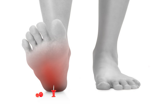 Woman Stepping Foot On Red Push Pin Red Highlighted On Pain Area, Unforeseen Concept, Black And White Color, Isolated On White Background.