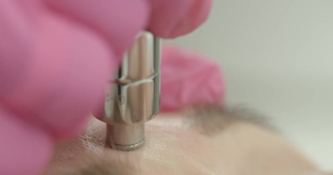 Vacuum Microdermabrasion. Close-up view of the beautician hands using the special machine for peeling. Facial anti-wrinkle treatment. 4k footage.