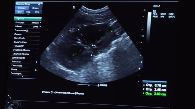 Ultrasound diagnostics with the image of internal organs on the screen of the monitor in a veterinary clinic. Medical ultrasound machine. Screen ultrasound machine. symbol diagnostics in healthcare.