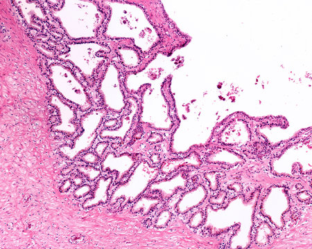 Human Seminal Vesicle