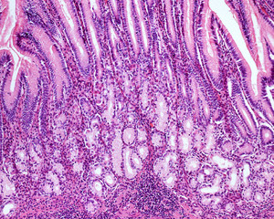 Fototapeta na wymiar Gastric mucosa. Pyloric región.