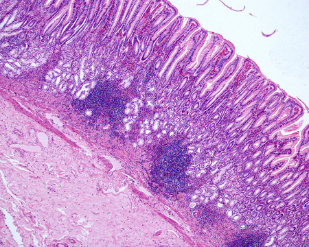 Gastric mucosa. Pyloric region