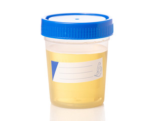 Plastic container with urine analysis on white background isolation