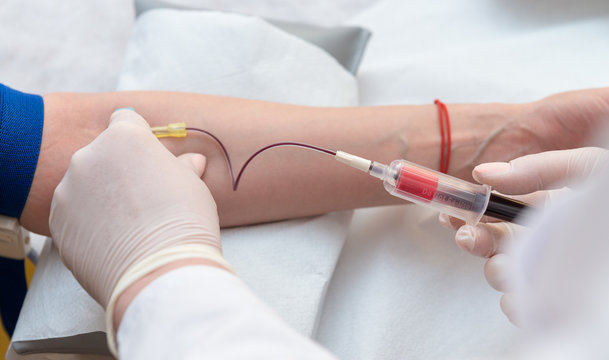 Close up of doctor hands sticking needle into female vein for blood sampling