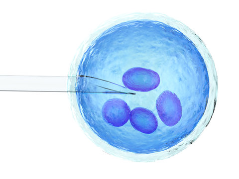 artificial insemination or ivf