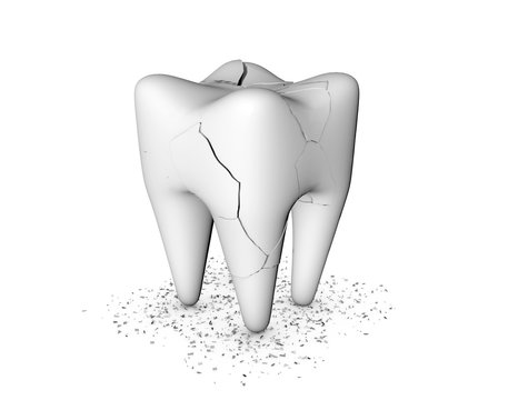 Toothache, dental care concept. Unhealthy, cracked and broken teeth on white background 3d render.