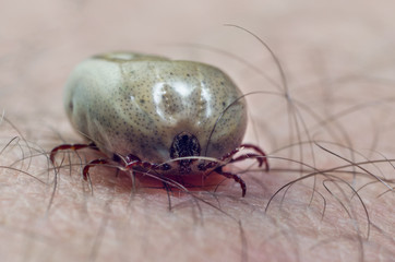 Tick filled with blood sitting on human skin