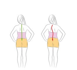 Correct alignment of human body in standing posture for good personality and healthy of spine and bone. Health care and medical illustration