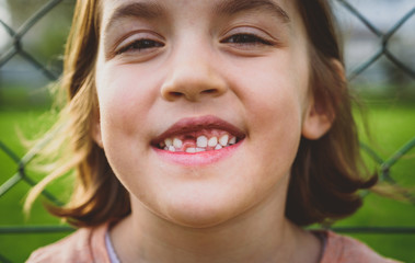 Portrait of toothless child girl missing milk and permanent teeth.