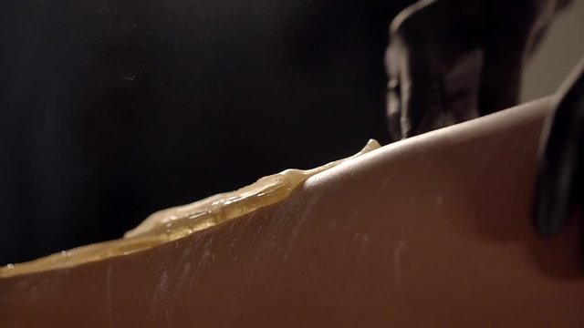 Master of sugaring is applying wax and quickly removing from skin of woman hip. Close-up in a beautician office in beauty shop