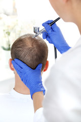 Tlenoterapia przeciw wypadaniu włosów. Głowa mężczyzny z przerzedzonymi włosami podczas...