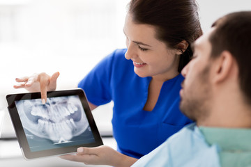 medicine, dentistry and healthcare concept - female dentist with tablet pc computer showing teeth x-ray to male patient at dental clinic office