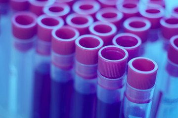 blood tube test for hand of a lab technician or medical doctor holding and background a rack of color tubes  and microscope with blood samples other patients in laboratory