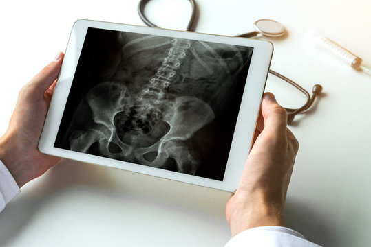 Doctor watching a x-ray of hips and spine for back pain on digital tablet. Radiology concept