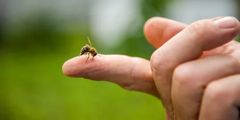 Foto auf Acrylglas Biene die Biene sticht der Person in den Finger