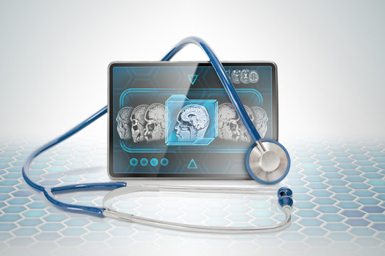 Medical tablet displaying cerebral anatomical scan