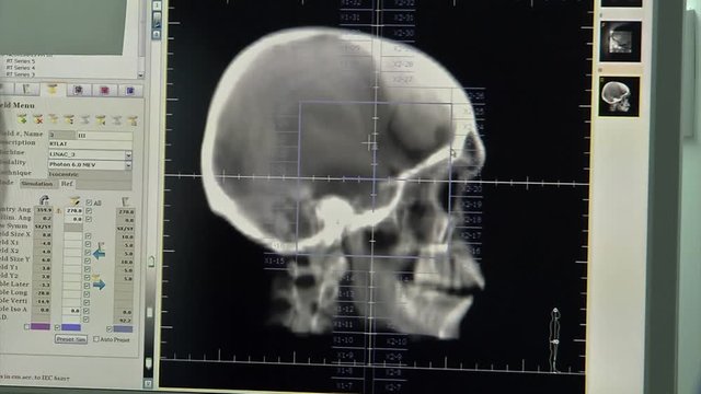 View Of Computer Screen As Medical Technician Review Cranial Scan