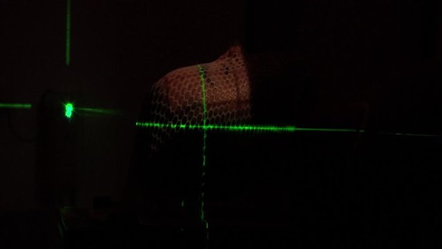 Dark hospital treatment room as patient has green laser lights across their face during radiation therapy
