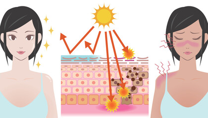 日焼けのメカニズム　日焼け止めあり／なし