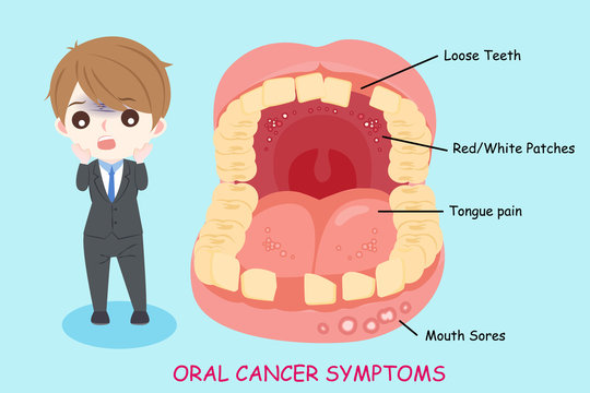 man with oral cancer symptoms