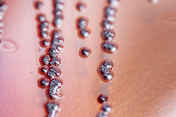 Colony Characteristics of Escherichia coli (E. coli) is a Gram-negative, facultatively anaerobic, rod-shaped, coliform bacterium of the genus Escherichia that is commonly found in the lower intestine.