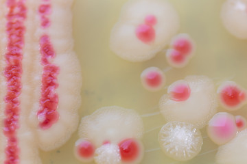 Serratia marcescens is a species of rod-shaped gram-negative bacteria in the family Enterobacteriaceae for Laboratory microbiology.
