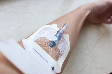 A female patient with a needle in her arm to a blood test