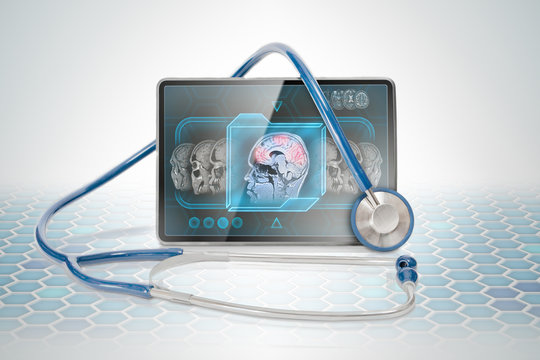 Medical tablet displaying cerebral activity scan