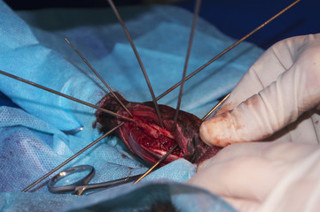 Osteosynthesis with external fixation (concept of surgery).