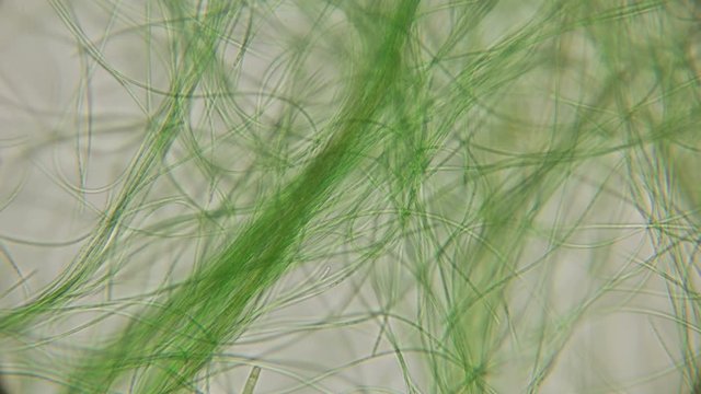 movement of live algae under a microscope, similar to the tentacles of the body, which is very exciting