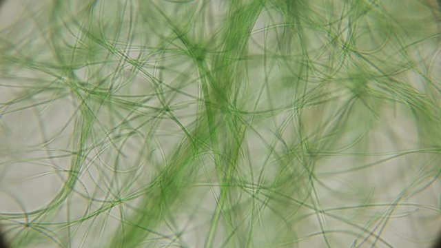 movement of live algae under a microscope, similar to the tentacles of the body, which is very exciting