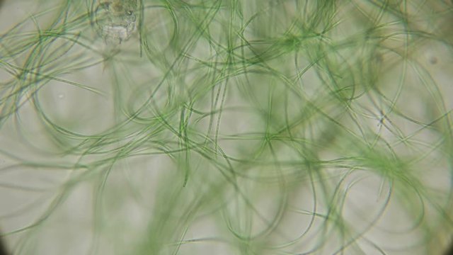 movement of live algae under a microscope, similar to the tentacles of the body, which is very exciting
