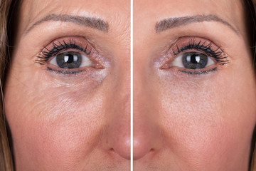 Fototapeta premium Woman With Before And After Rejuvenation