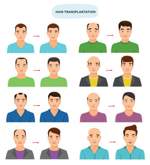 Hair transplant vector hairy transplantation after hairloss and baldness for bald man illustration set of hairless male character and haired person with haircat isolated on white background