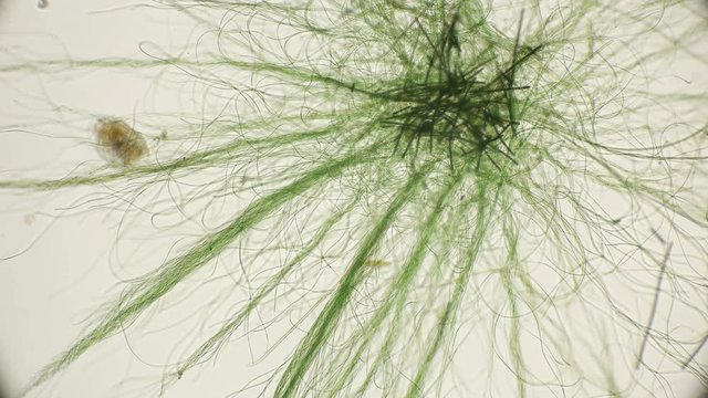 movement of live algae under a microscope, similar to the tentacles of the body, which is very exciting