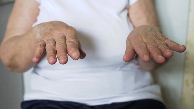 Parkinson And Hand Tremor Of An Old Woman