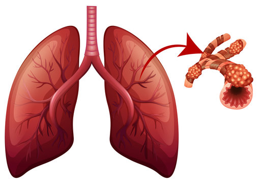 lungs with magnified part illustration